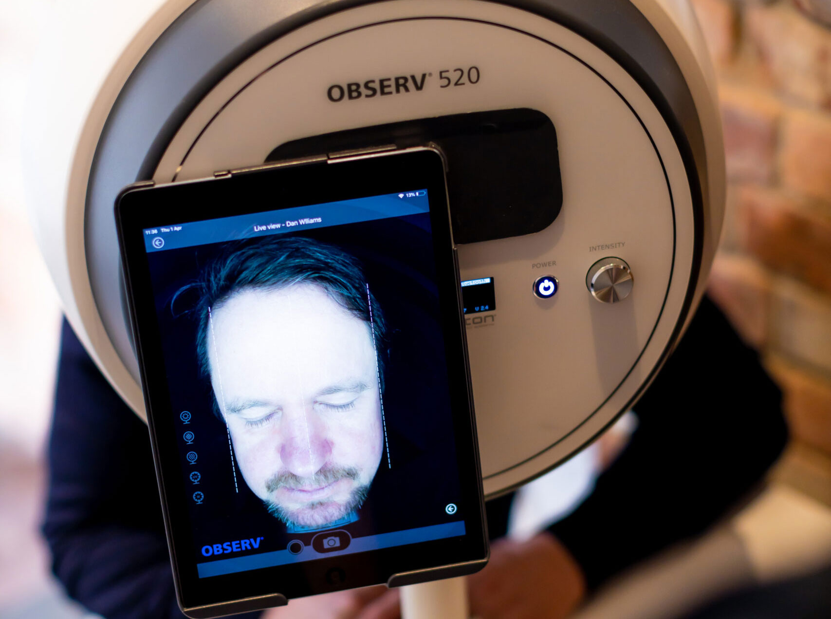 Skin Analysis with Observ 520 at EOS Aesthetics® in Berkshire