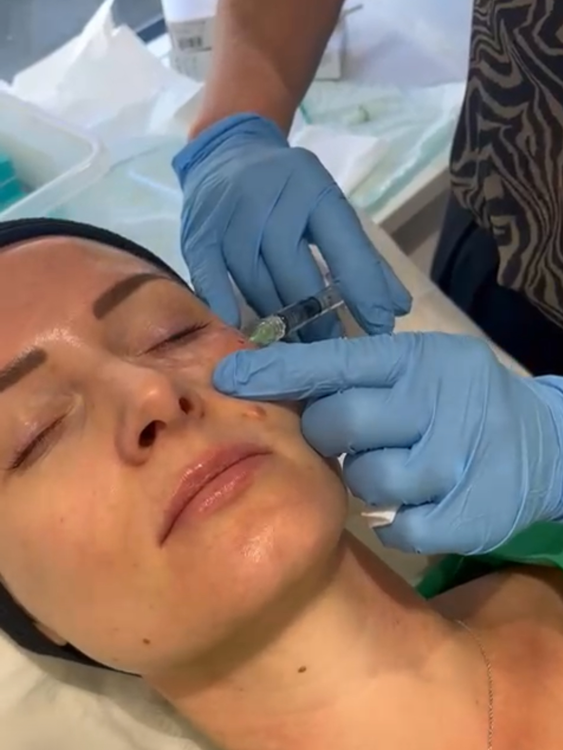 The Power Of Polynucleotides at EOS Aesthetics